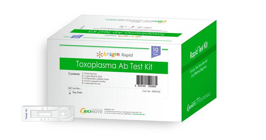 Toxoplasma Ab